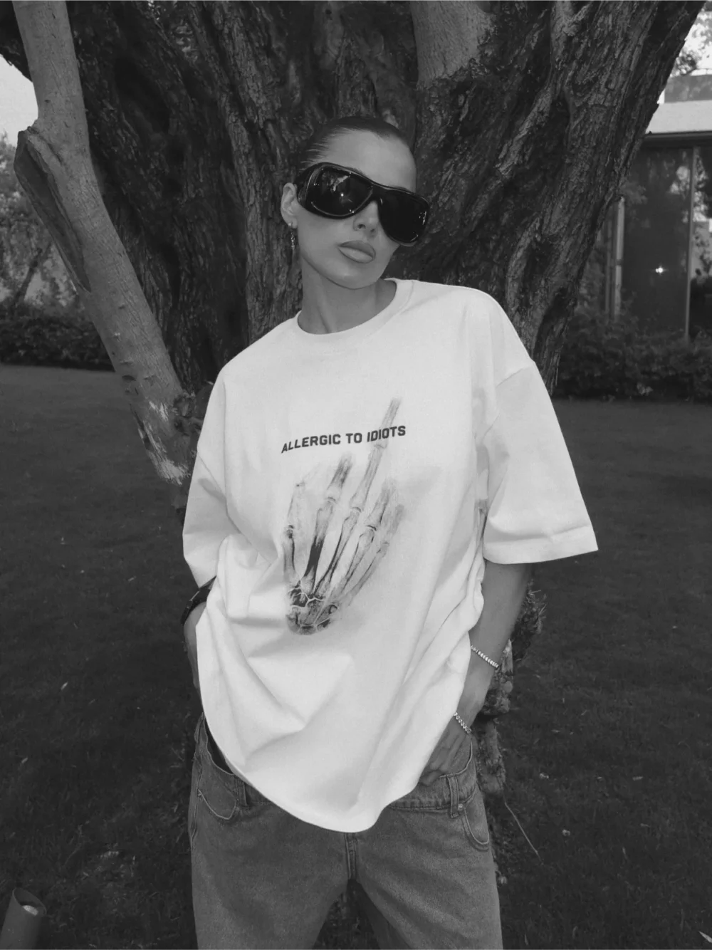 White Oversized T-Shirt: "Allergic to Idiots"